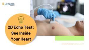 2d echo validity period|2D Echo Test Explained: Cost, Procedure & More .